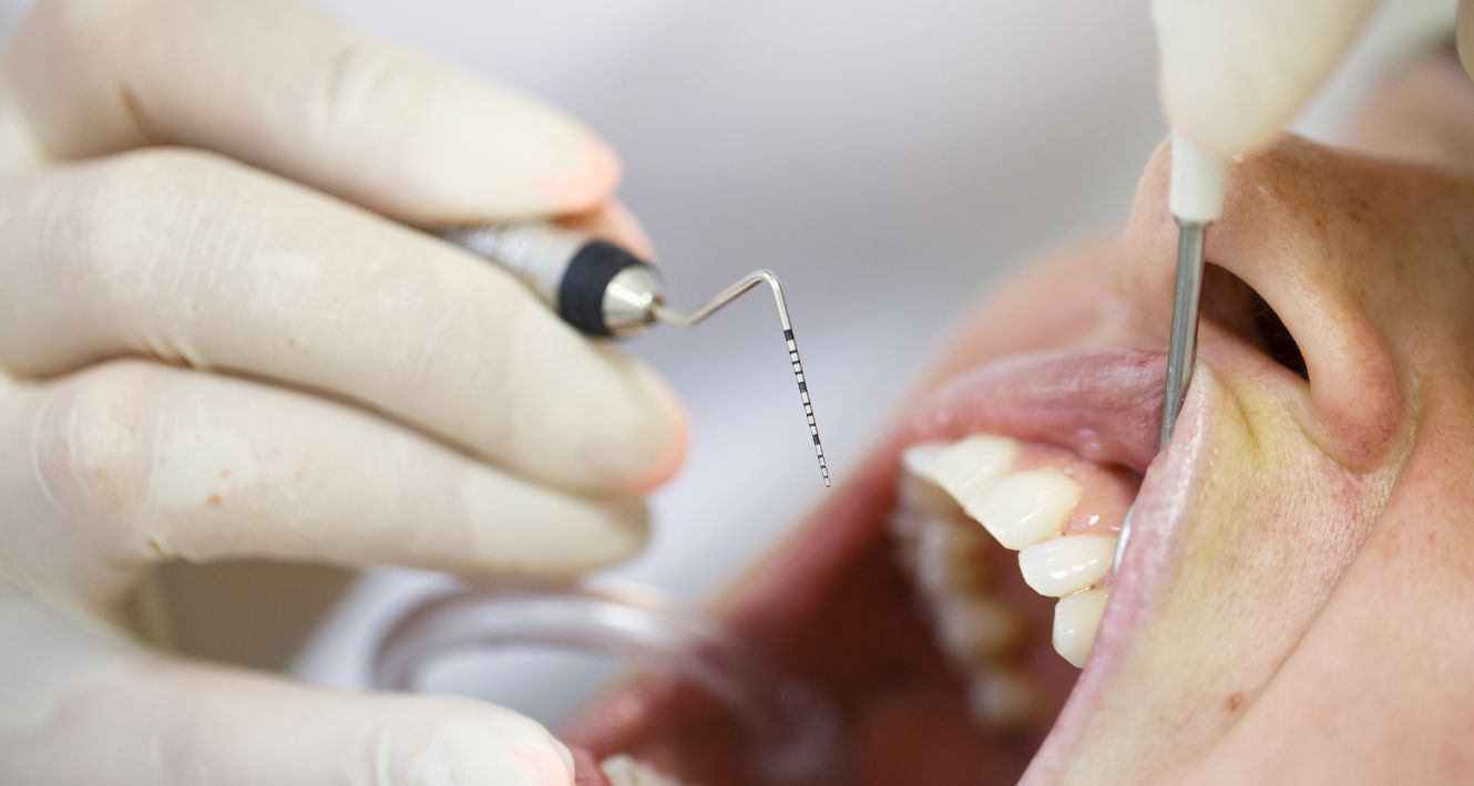 parodontiste toulouse - implantologue toulouse